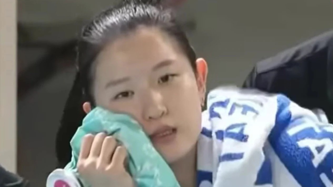 Lee Da Hyeon, pemain Hyundai Hillstate, mengompres mukanya yang sakit setelah kena smash keras dari Mega